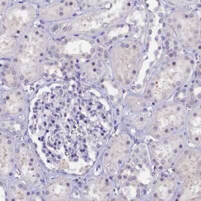 Immunohistochemistry-Paraffin: IQCN Antibody [NBP1-85833]