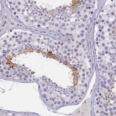 Immunohistochemistry-Paraffin: IQCN Antibody [NBP1-85833]