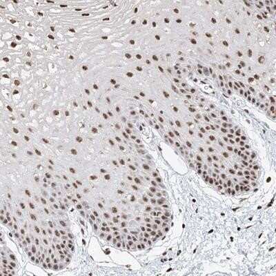 Immunohistochemistry-Paraffin: KIAA1704 Antibody [NBP1-89252]