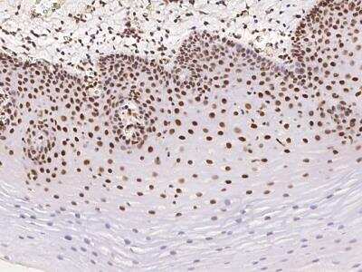 Immunohistochemistry-Paraffin: KIAA1704 Antibody [NBP3-06207]