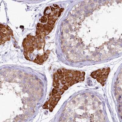 Immunohistochemistry: CEP295 Antibody [NBP2-38418]