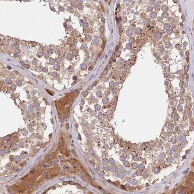 Immunohistochemistry-Paraffin: CEP295 Antibody [NBP1-90900]