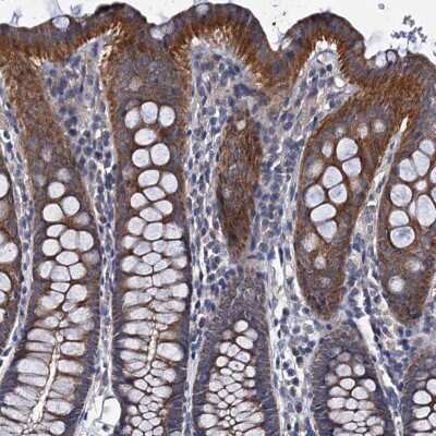 Immunohistochemistry-Paraffin: CEP295 Antibody [NBP2-38419]