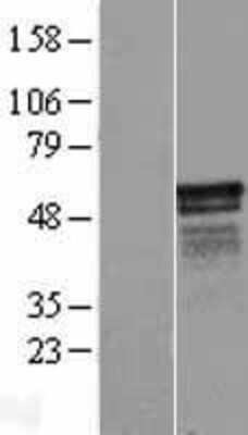 Western Blot: KIAA1737 Overexpression Lysate [NBL1-12277]