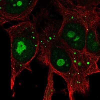 Immunocytochemistry/ Immunofluorescence: KIAA1755 Antibody [NBP2-14720]