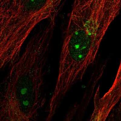 Immunocytochemistry/ Immunofluorescence: KIAA1755 Antibody [NBP2-14720]