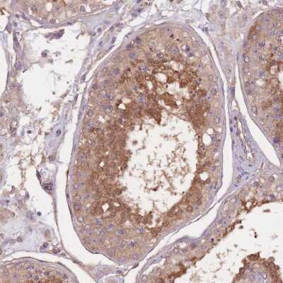 Immunohistochemistry-Paraffin: KIAA1755 Antibody [NBP2-14720]