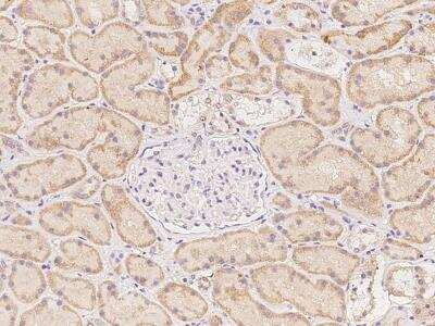 Immunohistochemistry-Paraffin: KIAA1755 Antibody [NBP3-06014]