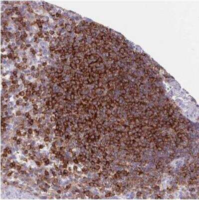 Immunohistochemistry: PPP1R18 Antibody [NBP2-30930]