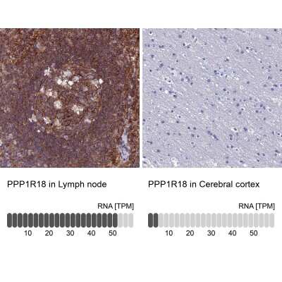 Immunohistochemistry-Paraffin: PPP1R18 Antibody [NBP2-30801]