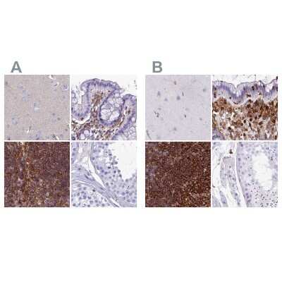 Immunohistochemistry-Paraffin: PPP1R18 Antibody [NBP2-30801]
