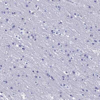 Immunohistochemistry-Paraffin: PPP1R18 Antibody [NBP2-30801]