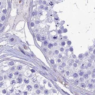 Immunohistochemistry-Paraffin: PPP1R18 Antibody [NBP2-30801]