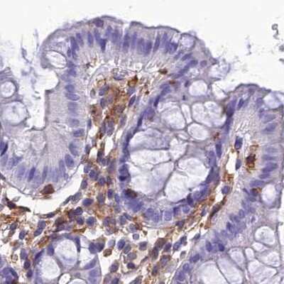 Immunohistochemistry-Paraffin: PPP1R18 Antibody [NBP2-30801]