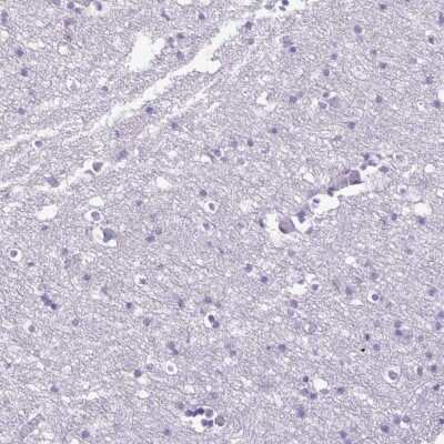 Immunohistochemistry-Paraffin: PPP1R18 Antibody [NBP2-30930]