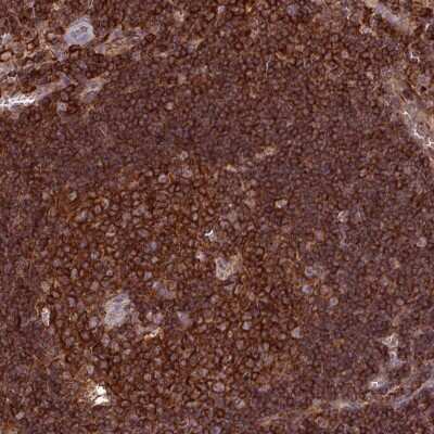 Immunohistochemistry-Paraffin: PPP1R18 Antibody [NBP2-30930]