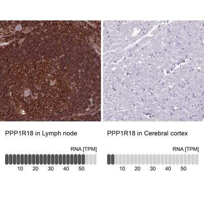 Immunohistochemistry-Paraffin: PPP1R18 Antibody [NBP2-30930]