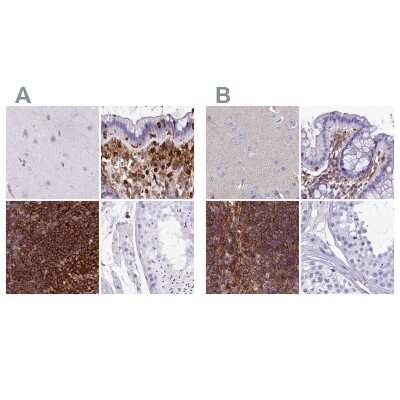 Immunohistochemistry-Paraffin: PPP1R18 Antibody [NBP2-30930]