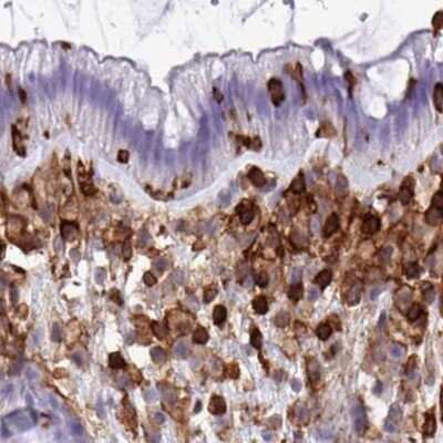 Immunohistochemistry-Paraffin: PPP1R18 Antibody [NBP2-30930]