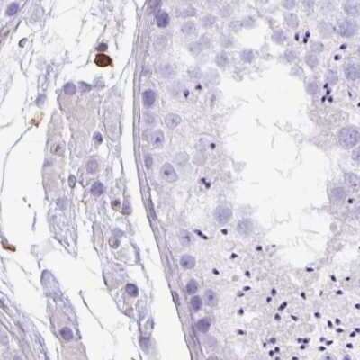 Immunohistochemistry-Paraffin: PPP1R18 Antibody [NBP2-30930]