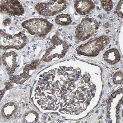 Immunohistochemistry-Paraffin: KIAA1958 Antibody [NBP1-81929]