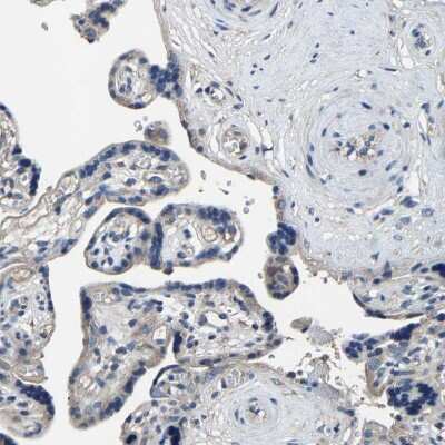 Immunohistochemistry-Paraffin: KIAA1958 Antibody [NBP1-81929]