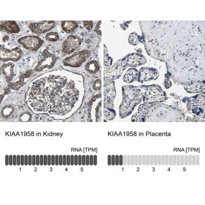 Immunohistochemistry-Paraffin: KIAA1958 Antibody [NBP1-81929]