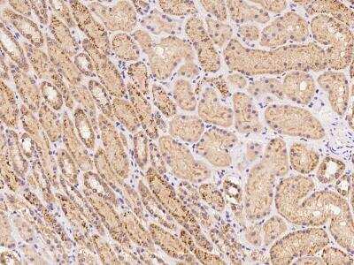 Immunohistochemistry-Paraffin: KIAA1958 Antibody [NBP3-06273]