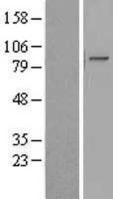 Western Blot: KIAA1958 Overexpression Lysate [NBL1-12282]