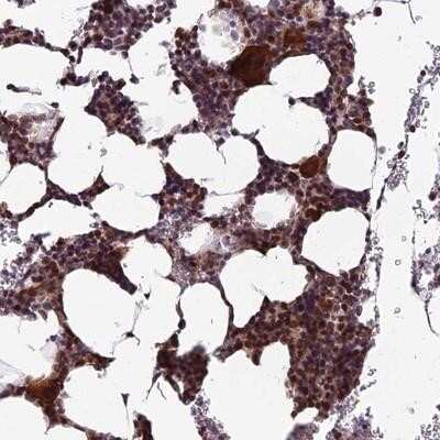 Immunohistochemistry-Paraffin: CCDC183 Antibody [NBP1-94134]