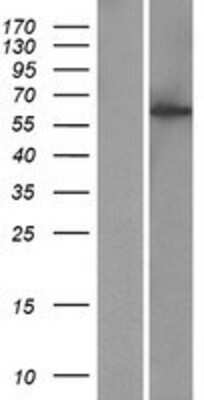 Western Blot: CCDC183 Overexpression Lysate [NBP2-08571]