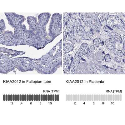 Immunohistochemistry-Paraffin: KIAA2012 Antibody [NBP3-16964]