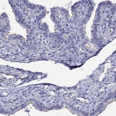 Immunohistochemistry-Paraffin: KIAA2012 Antibody [NBP3-16964]