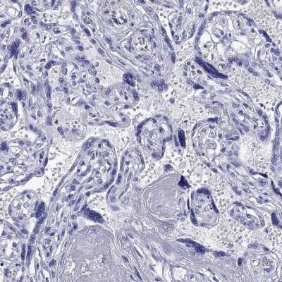 Immunohistochemistry-Paraffin: KIAA2012 Antibody [NBP3-16964]
