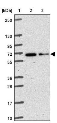 Western Blot: KIAA2013 Antibody [NBP2-30733]