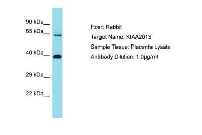 Western Blot: KIAA2013 Antibody [NBP2-85152]