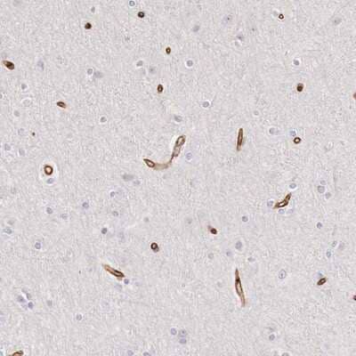 Immunohistochemistry-Paraffin: NEXMIF Antibody [NBP2-14156]