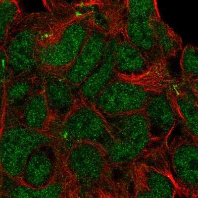 Immunocytochemistry/ Immunofluorescence: KIDINS220 Antibody [NBP1-88995]