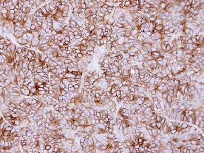 Immunohistochemistry-Paraffin: KIDINS220 Antibody [NBP1-31216]