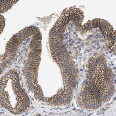 Immunohistochemistry-Paraffin: KIDINS220 Antibody [NBP1-88995]