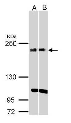 Western Blot: KIDINS220 Antibody [NBP1-31216]