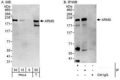 Western Blot: KIDINS220 Antibody [NBP1-50034]