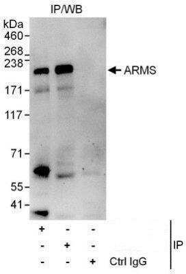 Western Blot: KIDINS220 Antibody [NBP1-50035]