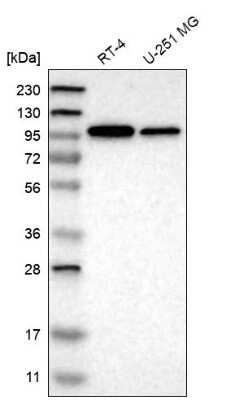 Western Blot: KIDINS220 Antibody [NBP1-88995]