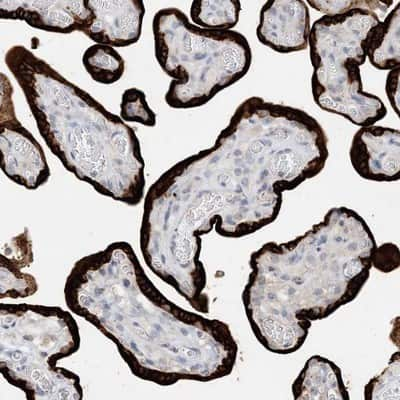 Immunohistochemistry-Paraffin: KIF1-binding protein Antibody [NBP1-84143]