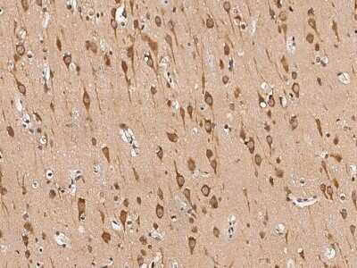 Immunohistochemistry-Paraffin: KIF1-binding protein Antibody [NBP2-97110]