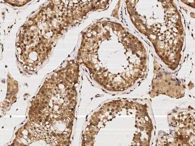 Immunohistochemistry-Paraffin: KIF1-binding protein Antibody [NBP2-97110]