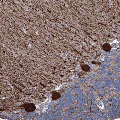 Immunohistochemistry: KIF13A Antibody [NBP1-88757]