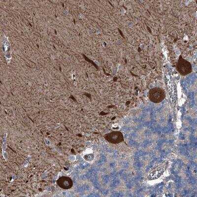 Immunohistochemistry-Paraffin: KIF13A Antibody [NBP1-88758]