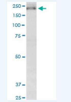 Western Blot: KIF13B Antibody (6E11) [H00023303-M01-100ug]